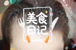 -大麦微针植发全国连锁