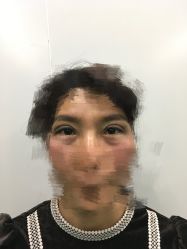 点击看大图 -郑州米兰柏羽集美医疗美容医院