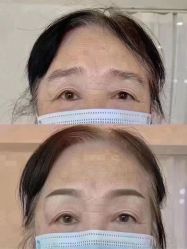 -郡艺医疗美容·微整·眼鼻吸脂