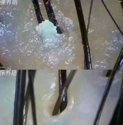 -希梵尔头皮抗衰·科技养发