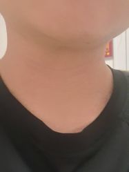 -北京美痣堂古方祛痣斑疣瘊