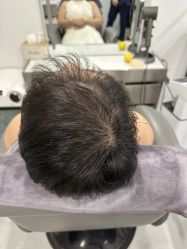 -熙朵美学植发·连锁品牌