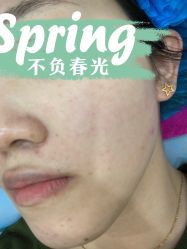 体验前-北京米扬丽格医疗美容·联合丽格鼻整形中心