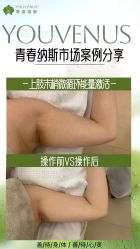 -半岛故事·法儿曼抗衰·indiba中心