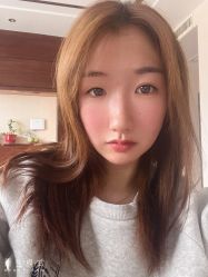 体验后-圣嘉新医疗美容医院