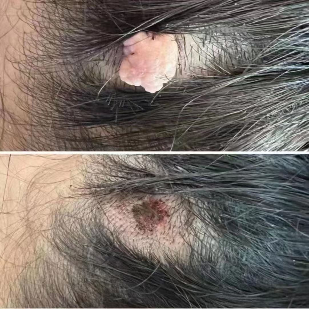 你的头上有这个大肉瘤吗!