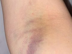 -成都市第一人民医院(南区)