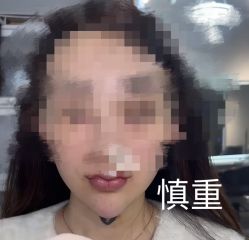 -深圳艺星医疗美容医院