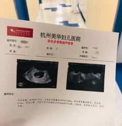 -杭州贝瑞斯美华妇儿医院·早孕·产检·儿科