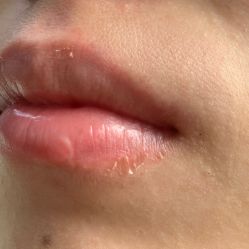 -净妍美肌专业净毛嫩肤连锁机构