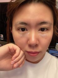 -北京美痣堂古方祛痣斑疣瘊