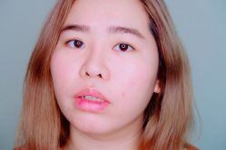 -SKINIST丽铂医疗美容