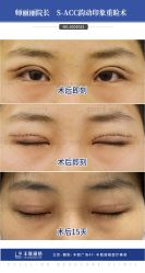 -丰联丽格医疗美容·联合丽格眼整形中心