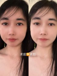 -伊丽莎白医疗美容