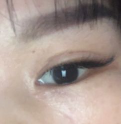 体验后-广州美莱医疗美容医院