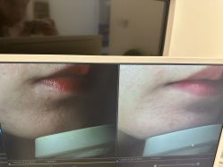 点击看大图 -苑苑vbeauty科技美容SPA