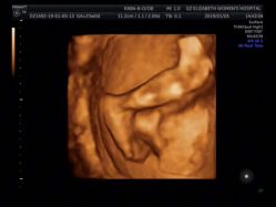 -郑州万安妇产医院