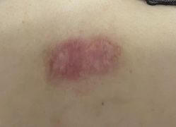 -正璞医疗美容·皮肤修复·微整注射