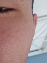 -肤原祛痘修肤中心