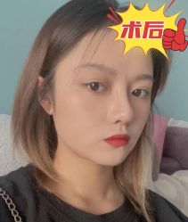 -素美医疗美容·西南眼鼻整形·修复基地