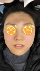 点击看大图 体验后-和颜一美轻医美连锁