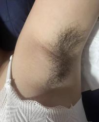 -薇兰专业脱毛连锁机构