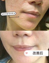 -天津健丽·去眼袋医疗美容机构