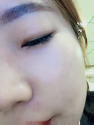 -YooMee优美智能科技美肤机构