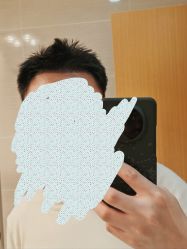 -大麦微针植发丨全国连锁