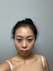 -广东韩妃整形外科医院
