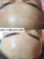 -MLP美丽派·问题肌疗愈中心