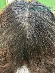 点击看大图 -舒欣头疗·俏丝谧语 白发脱发专业护理