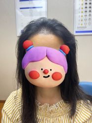 -大麦微针植发全国连锁