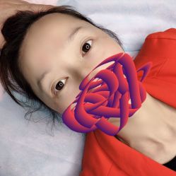 点击看大图 -郡艺医疗美容·微整·眼鼻吸脂
