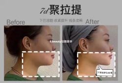 点击看大图 -E.beauty驻颜·痘敏肌调理中心