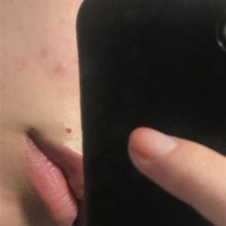 -厦门美莱整形美容医院