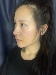 -杭州奥拉克医疗美容门诊部