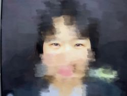 体验前-郑州米兰柏羽集美医疗美容医院