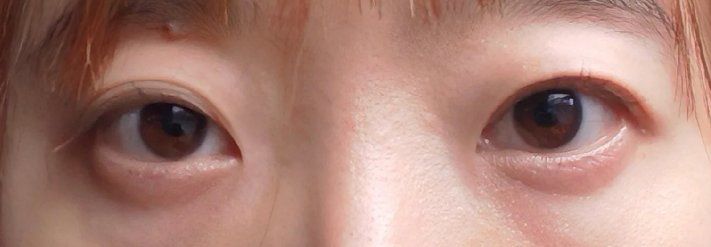 -紫洁俪方（北京）医疗美容