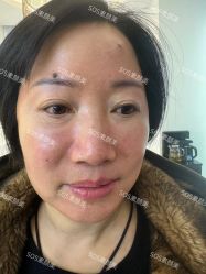 -SOS修丽可.痘肌修复中心