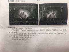 -中国人民解放军总医院(301医院)