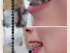 -团圆口腔·种植中心(锦江院区)