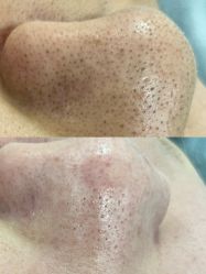 -SKIN79皮肤管理中心