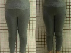 -修申骨雕小颜脊柱骨盆管理产后修复