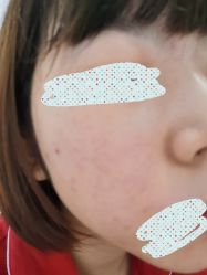 体验后-坤如玛丽·医疗美容中心