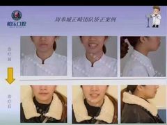 -柏乐口腔(南宁总院)