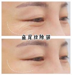 -上海漾颜医疗美容