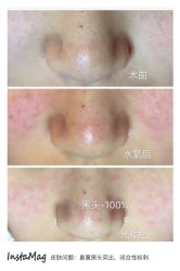 光SPA水氧+op t-光SPA科技美肤