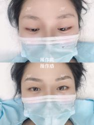 -西施无菌半永久纹绣眉眼影唇轻增发纹发际线