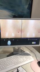 -苑苑vbeauty科技美容SPA